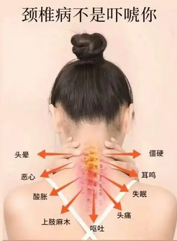  久坐办公室怎么保护颈椎，每天 5 分钟就够