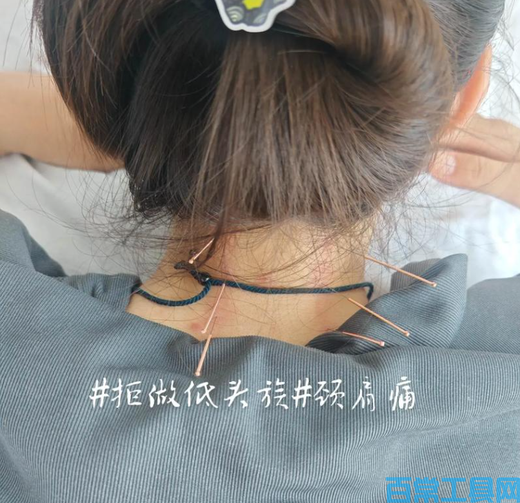 久坐办公室怎么保护颈椎，每天 5 分钟就够